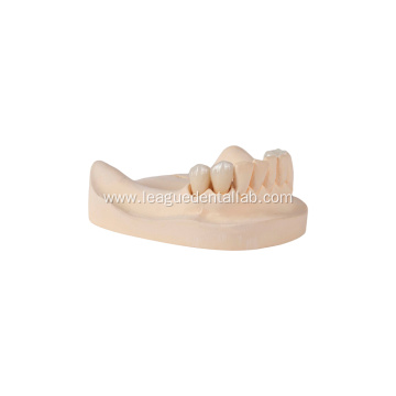 High Translucent Dental Layered Zirconia
